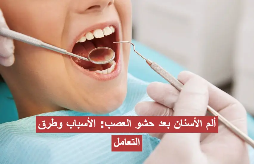 ألم الأسنان بعد حشو العصب